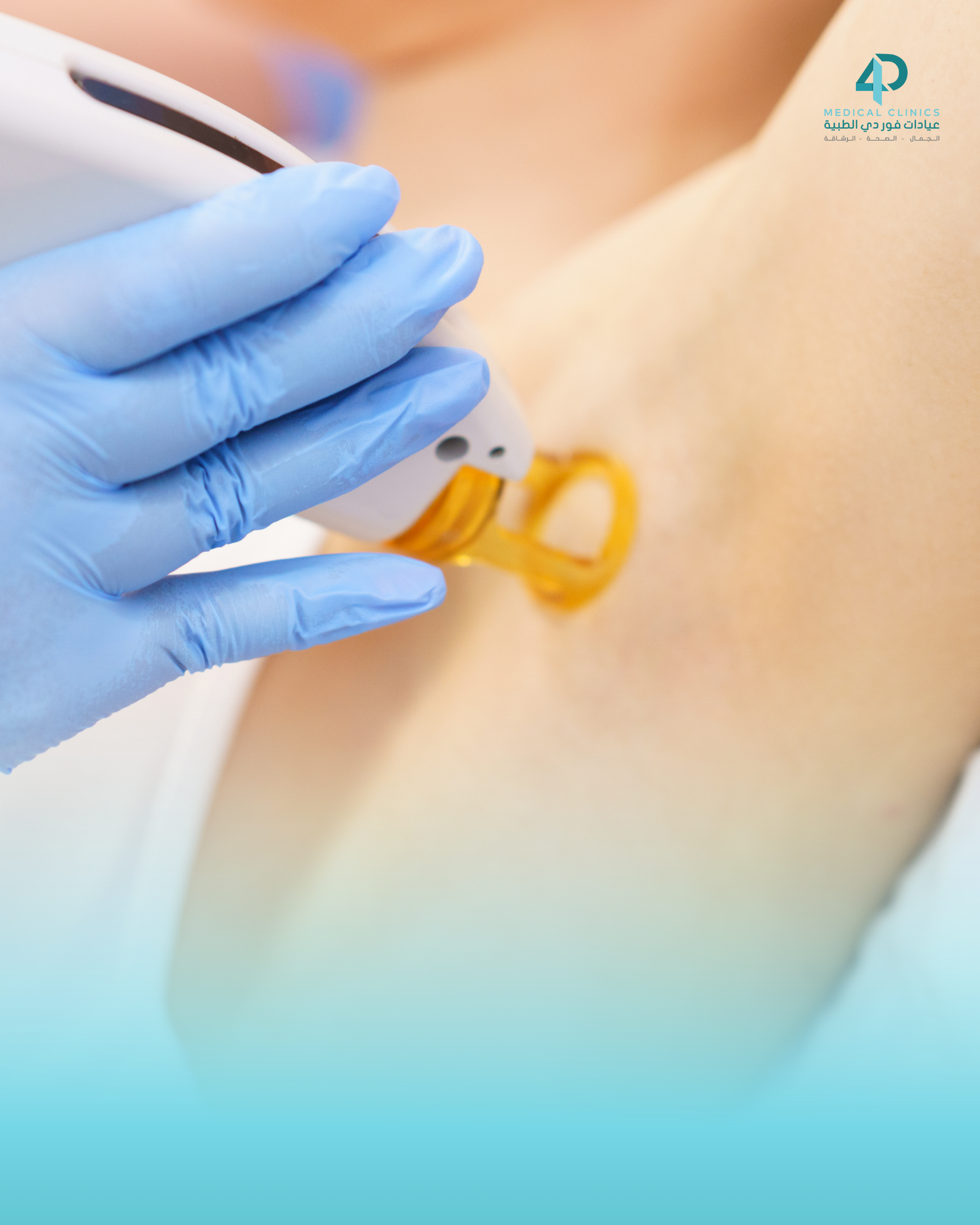 Botox underarm